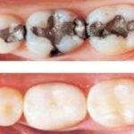 لماذا تعتبر مضخات قروندفوس الخيار الأمثل؟ اكتشف الحلول الذكية مع شركة الآلة