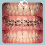 ما الفرق بين تصنيع ايس كريم في المنزل والمصنع؟